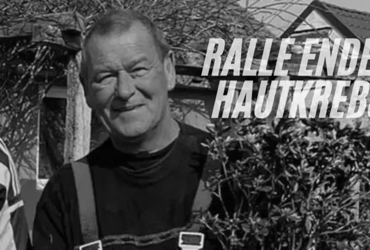 Ralle Ender Hautkrebs